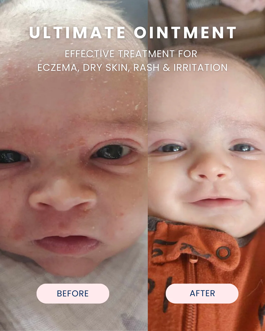 Ultimate Baby Ointment - Image 10