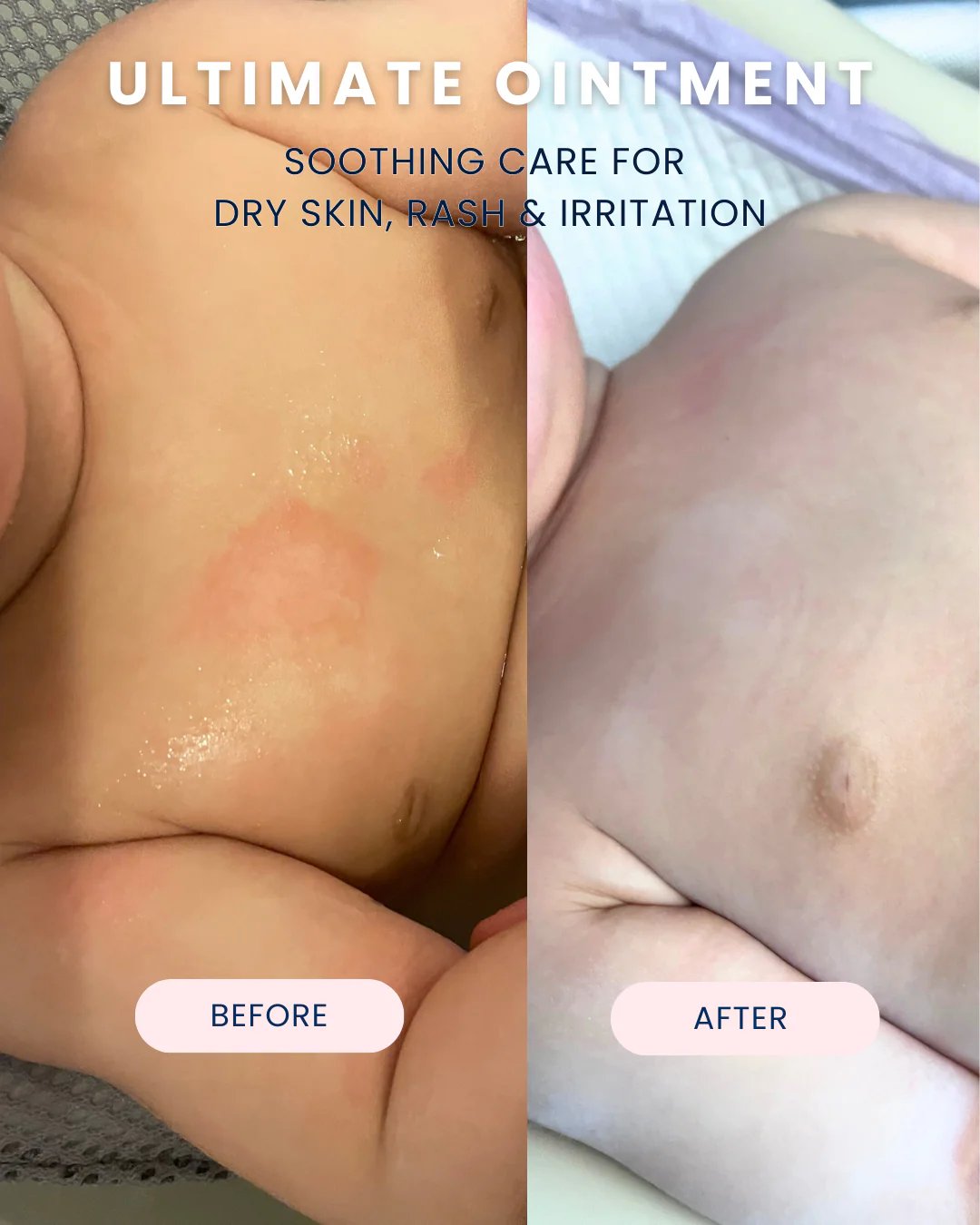 Ultimate Baby Ointment - Image 12