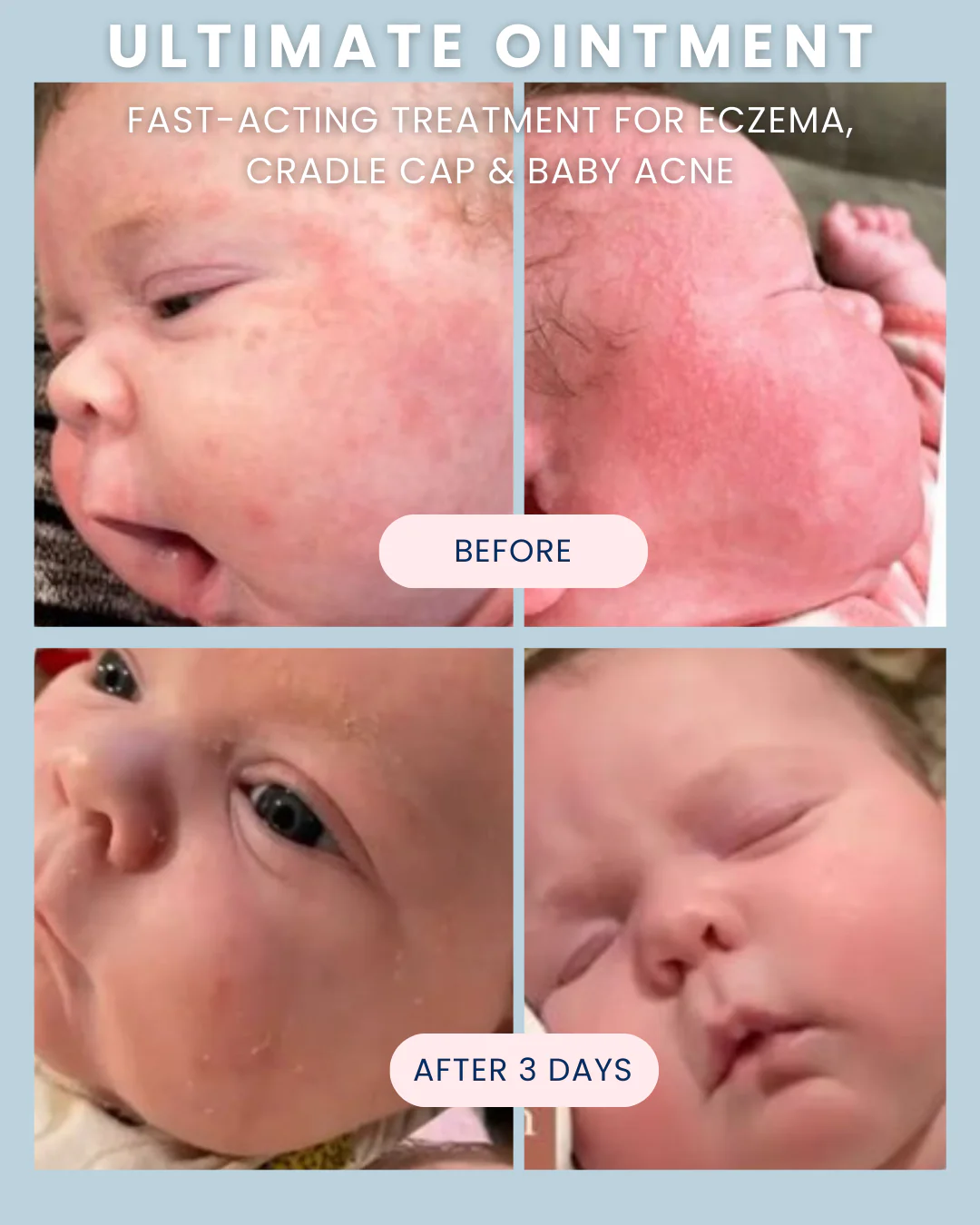 Ultimate Baby Ointment - Image 8